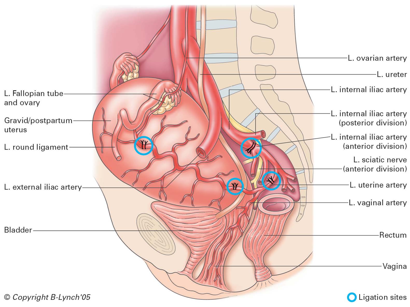 Low Lithotomy Position Surgery