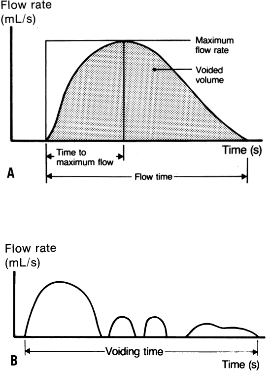 Normal Uroflow Chart