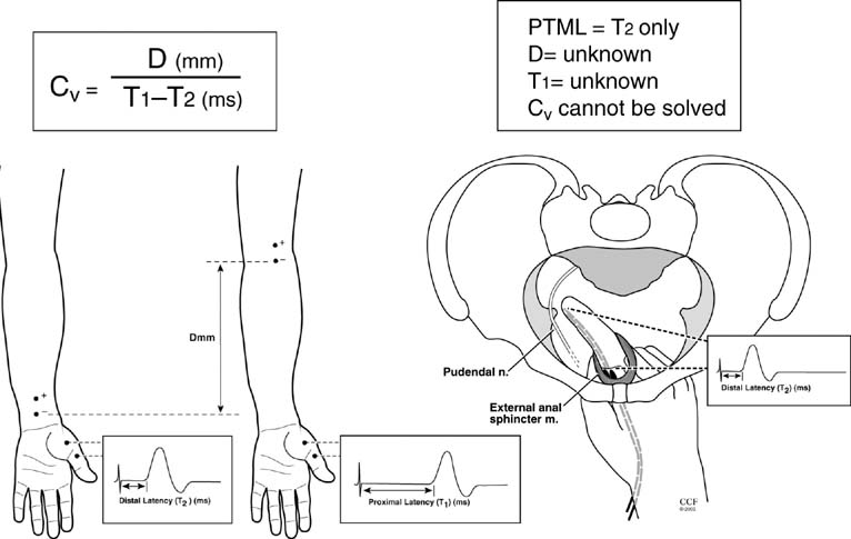 What is involved in a neurological nerve conduction test?