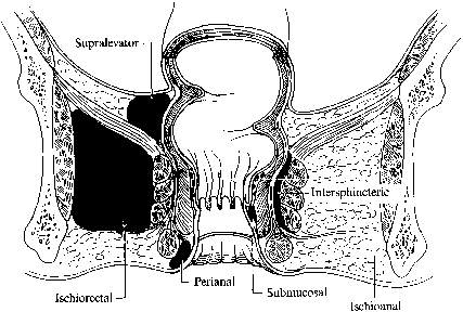 Location of anal fistula