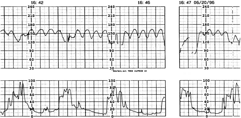 fetus normal heartbeat