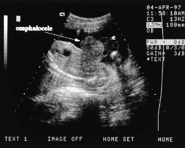 Diagnostic Obstetric Ultrasound Glowm