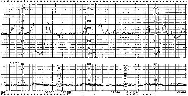 Fetal Heart Rate Categories Chart