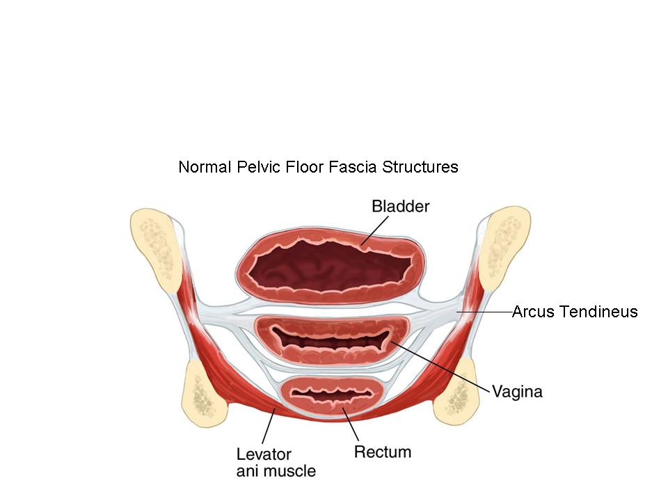 The Pathophysiology Diagnosis And Management Of Rectoceles