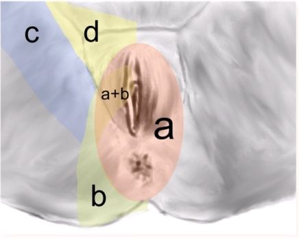 pudendal neuralgia pillow