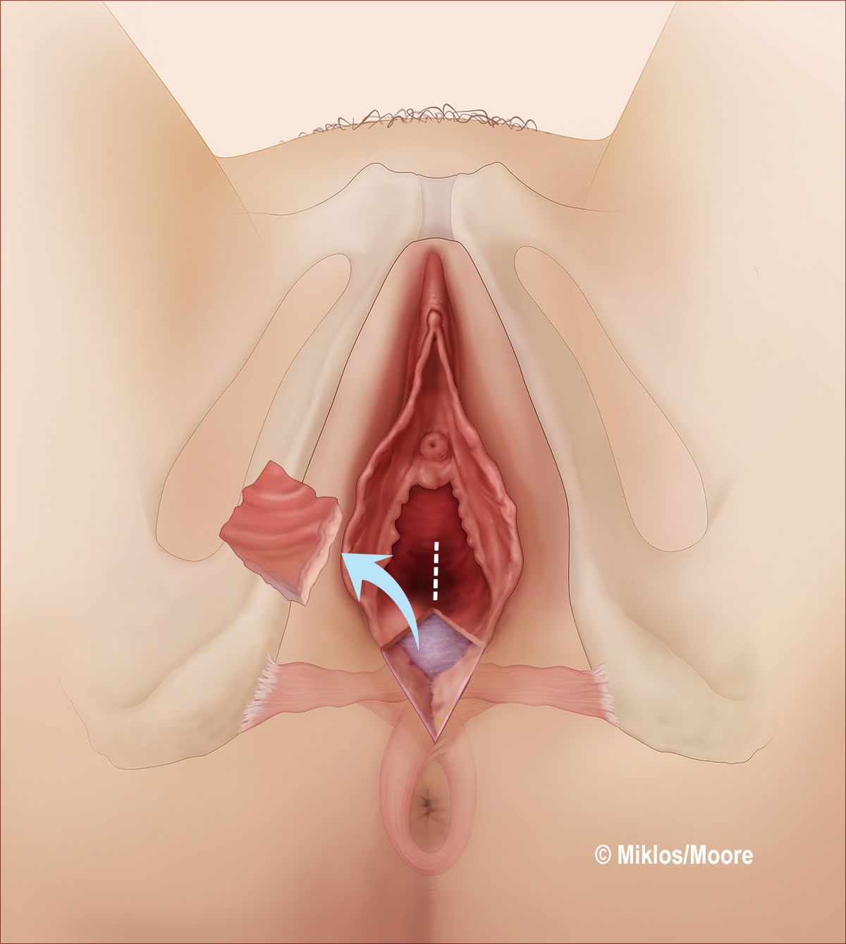 Female vagina structure