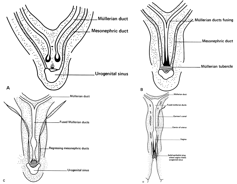 Developmental Abnormalities of the Female Reproductive Organs