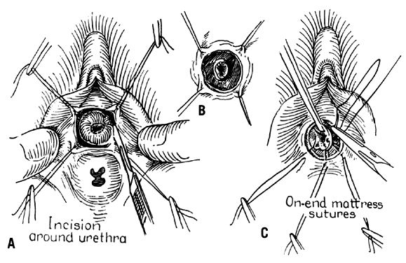 Vulva opening with funnel-shaped protruding ovijector in Aonchotheca