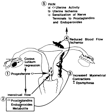 Dysmenorrhea: Menstrual Cramps