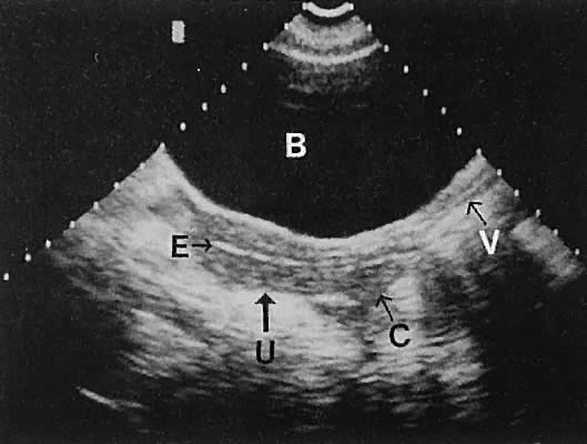 Diagnostic Ultrasonography in Gynecology | GLOWM