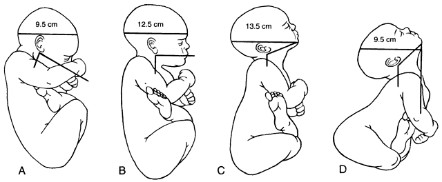 abnormal fetal presentation meaning