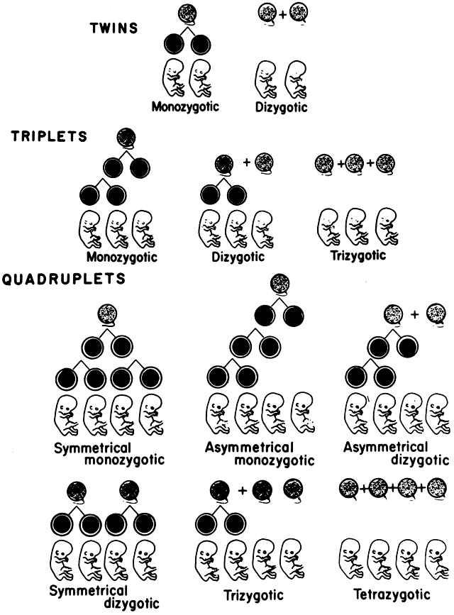 quadruplets pregnancy week by week