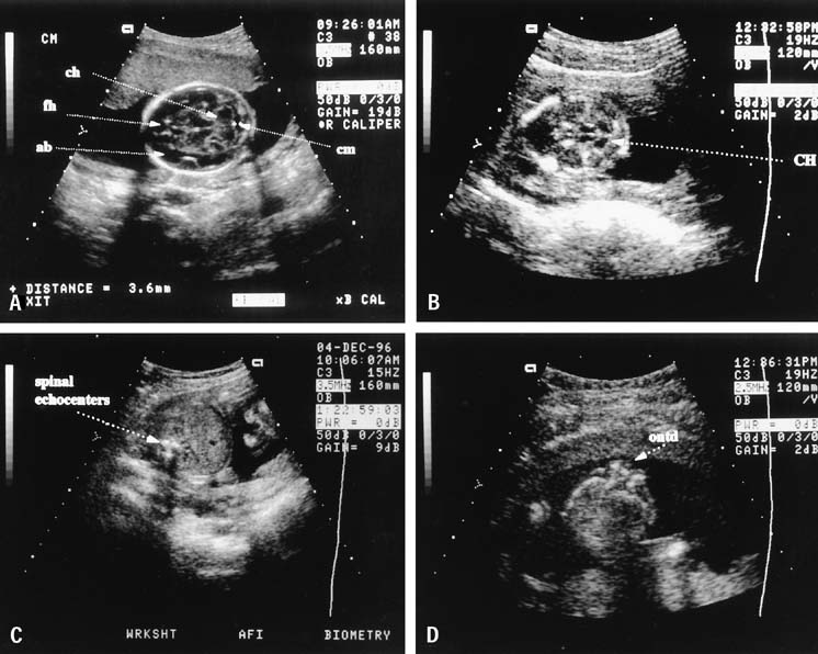 Diagnostic Obstetric Ultrasound Glowm