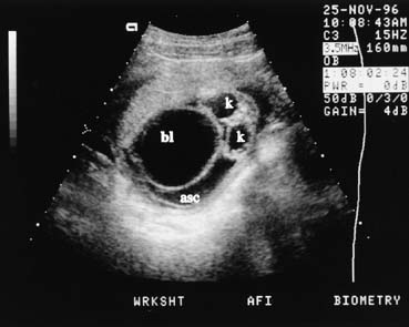 Diagnostic Obstetric Ultrasound Glowm