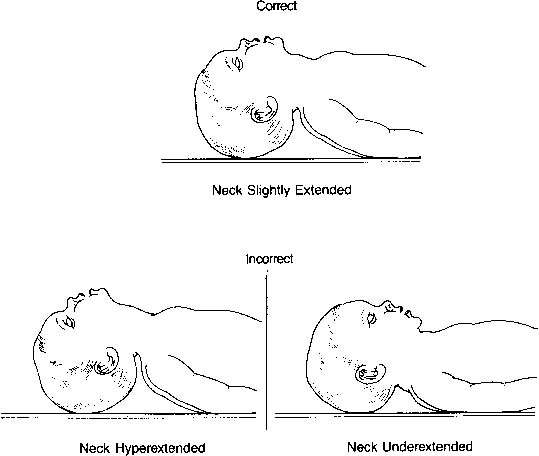 neonatal-resuscitation-glowm