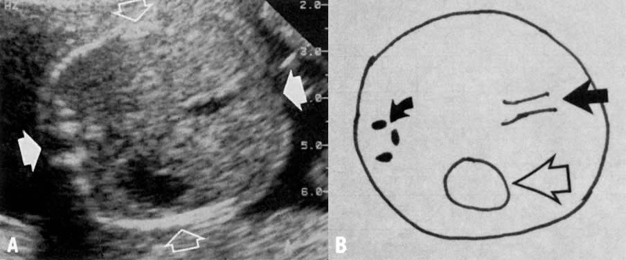 Gestational chart ultrasound age measurements Canine and