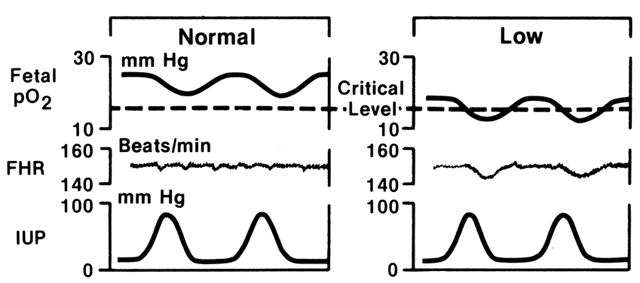 Contraction stress test: How and why it's done