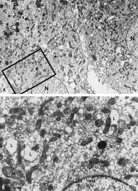 Luteal Cell - an overview