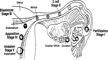 implantation diagram