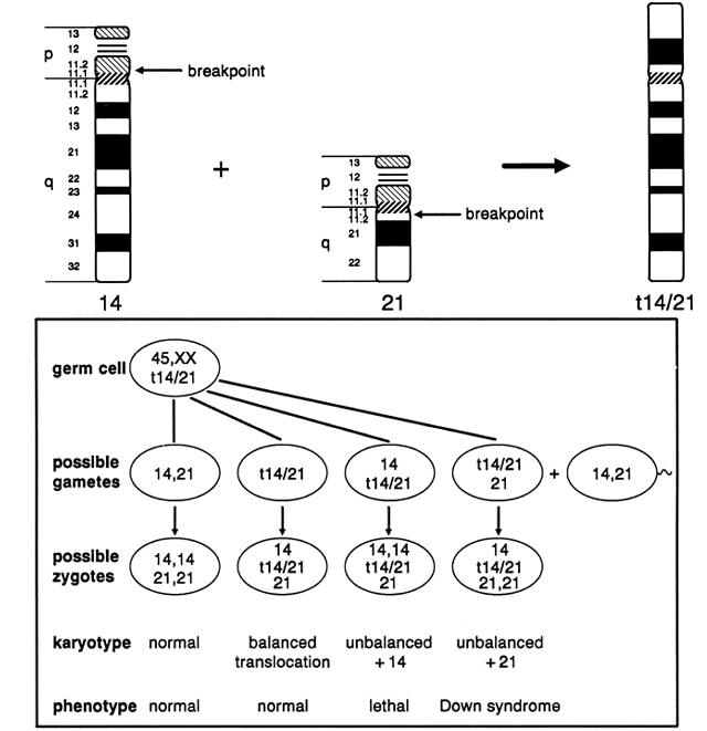 Molecular mechanism in the formation of a human ring chromosome 21. -  Abstract - Europe PMC