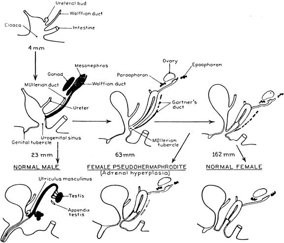 Congenital Adrenal Hyperplasia Genitalia Pictures