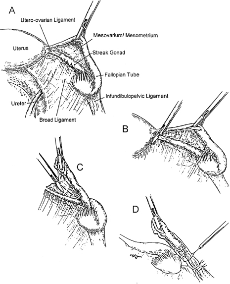 Cytogenetic Teratogenic And Miscellaneous Other Disorders Causing