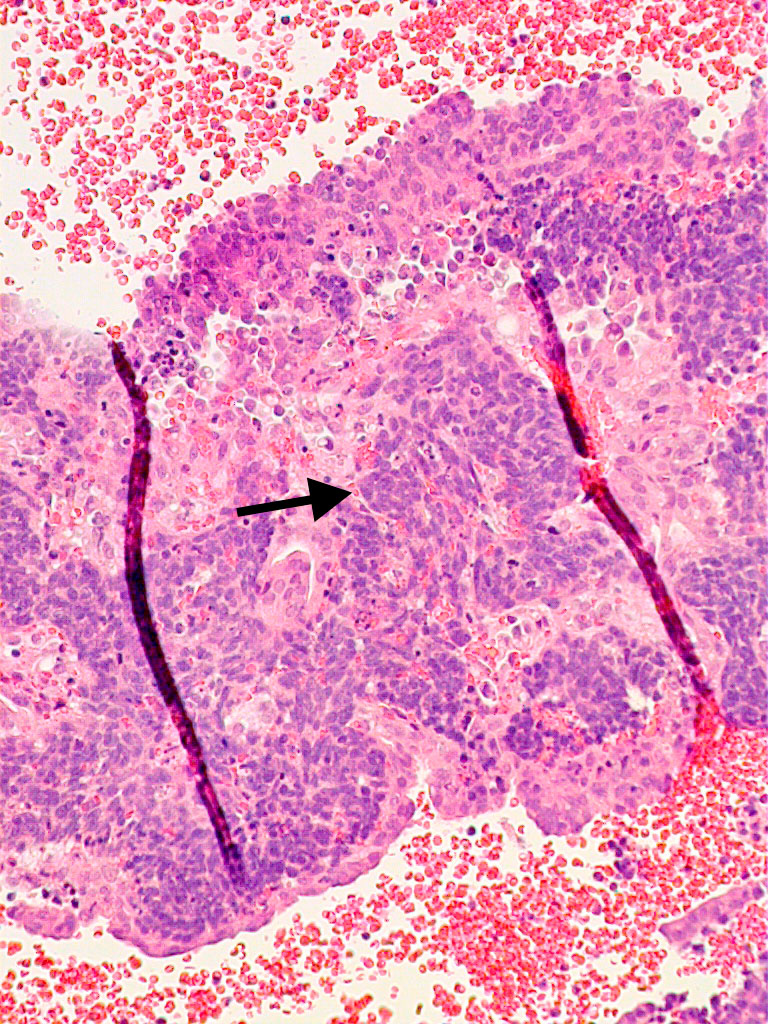 Uterine Histology In The Menstrual Cycle Left And Centre