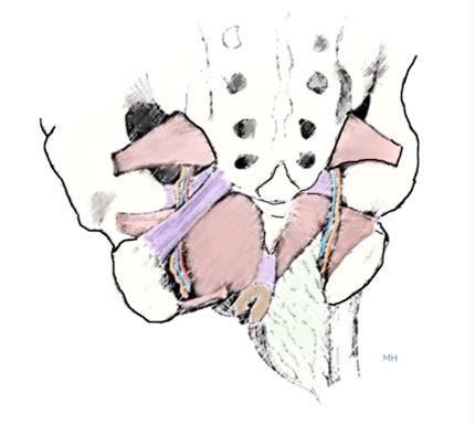 bilateral pudendal nerve block