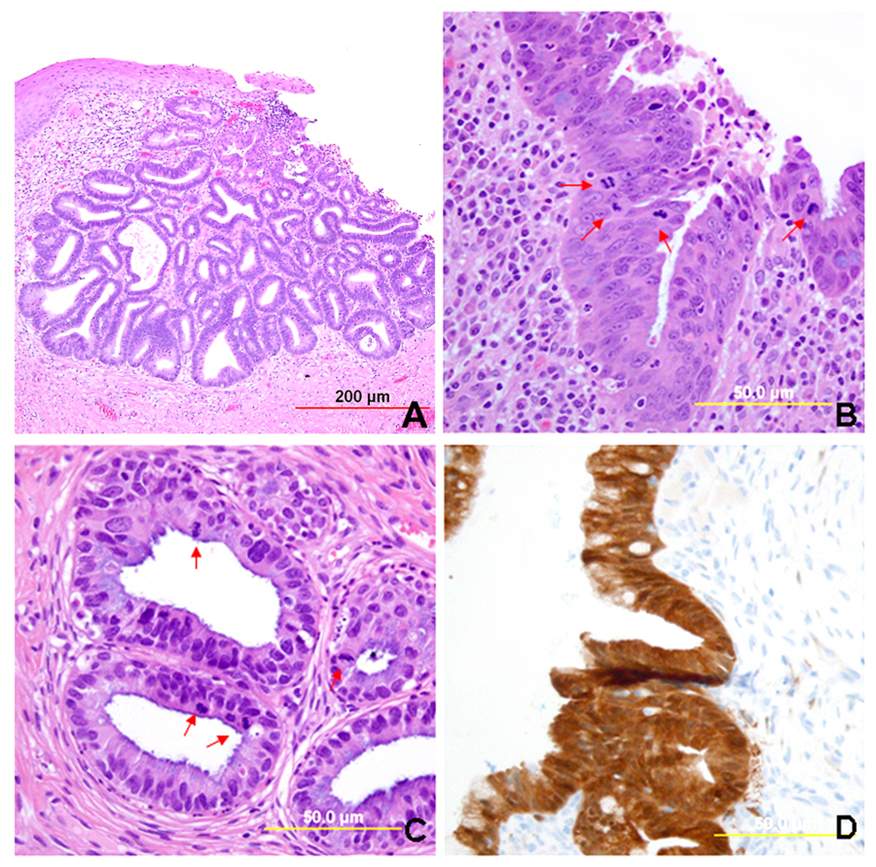 endocervix histology