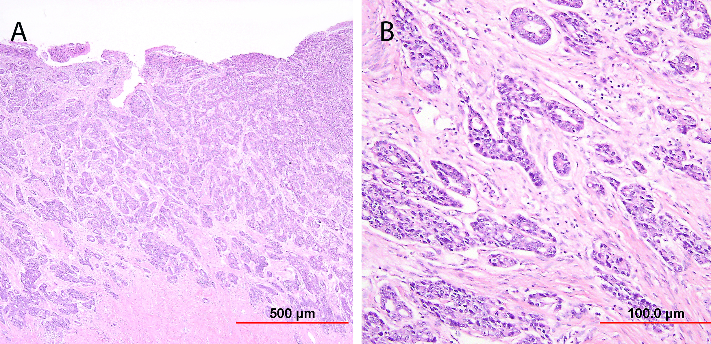 endocervix histology